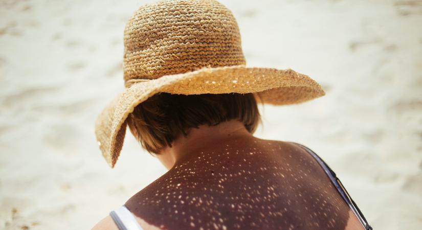 Termálvízben rejlik a fényvédelem jövője?