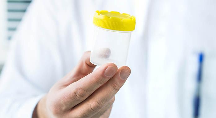 Mindent a spermadonációról