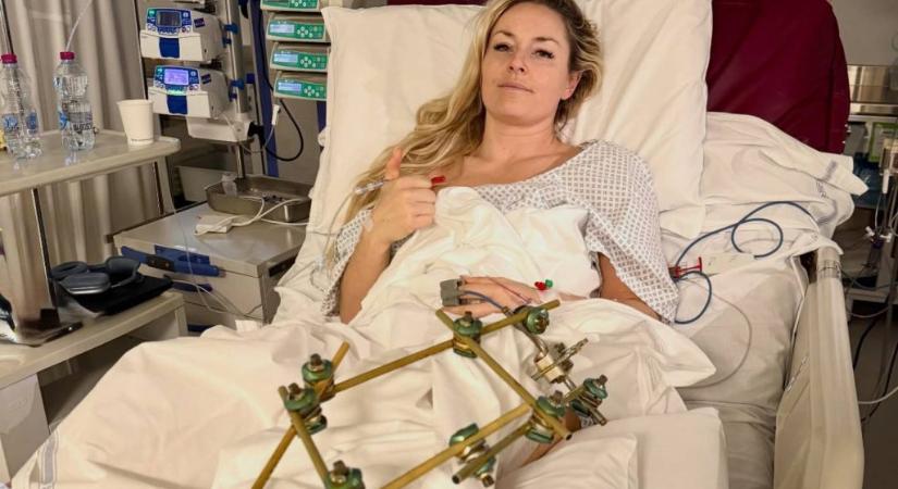 Lindsey Vonn ripityára tört sípcsontját négy nap alatt harmadszor is megműtötték