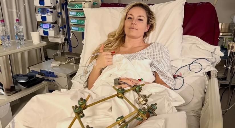 Kórházi ágyából posztolt Lindsey Vonn – fotó