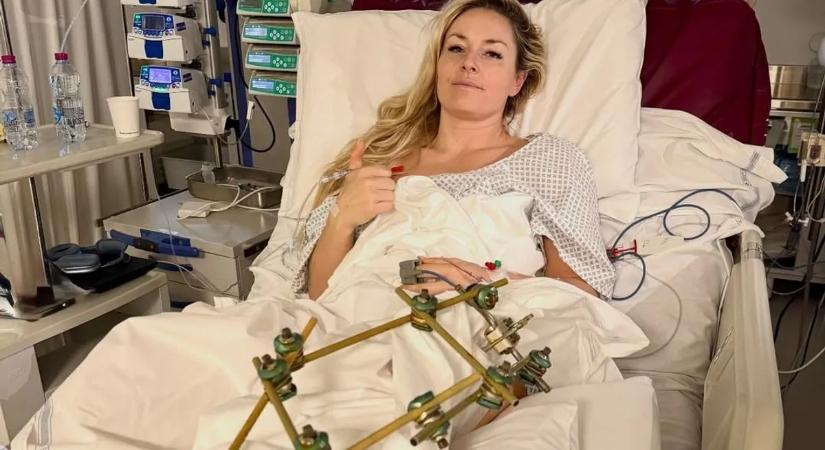 Megrázó fotó a kórházból: mi történik Lindsey Vonn-nal?