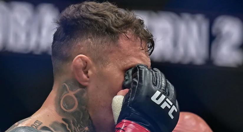 Hatalmas a baj: mindkét szemét meg kellett műteni az UFC világbajnokának – videó