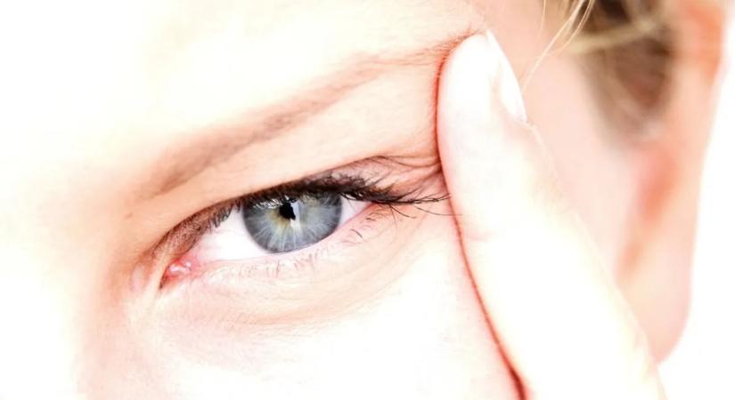 Rángatózó szemhéj: ártalmatlan jel vagy fontos figyelmeztetés?