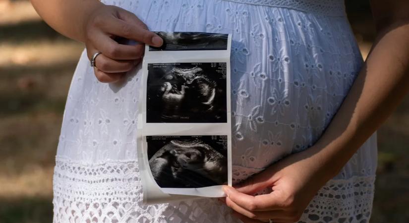 Második gyermekét várja a Dancing sztárja