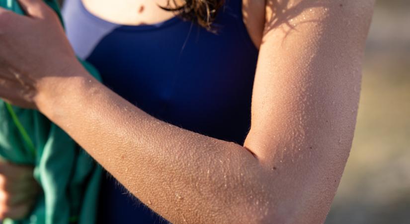 Egy furcsa testi működés – Mi értelme a libabőrözésnek?