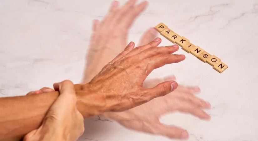 Parkinson-kór: nem mindig kézremegéssel kezdődik, ezek lehetnek a korai jelek