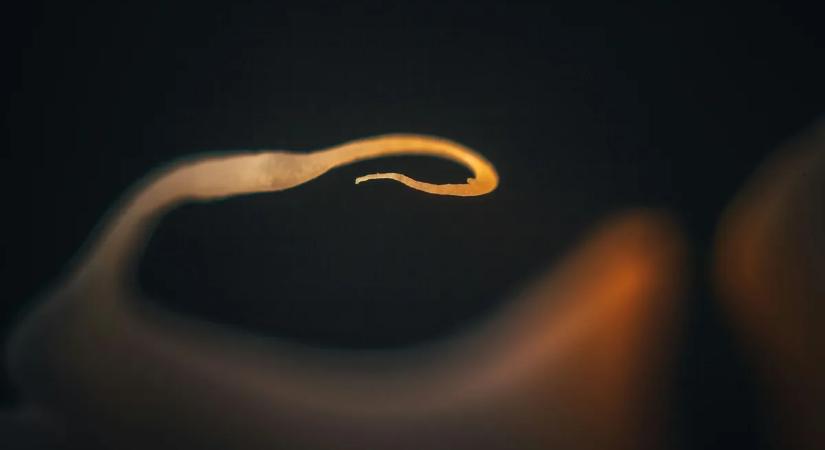 Nem stressz és nem vitaminhiány – akár galandféreg is okozhatja