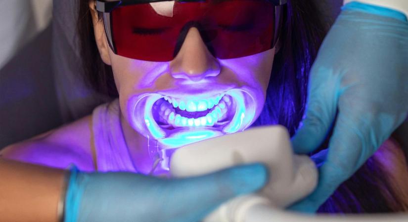 Fogfehérítés elektromos fogkefével?