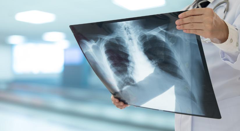 Tbc az iskolában: újabb fertőzötteket diagnosztizáltak Szeged mellett