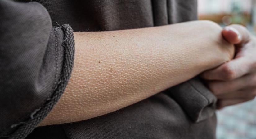 Libabőrös lettél? A tudomány megadta a választ!