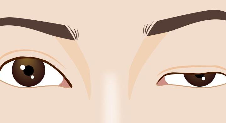 Ne tudd meg, milyen az élet pislogás nélkül