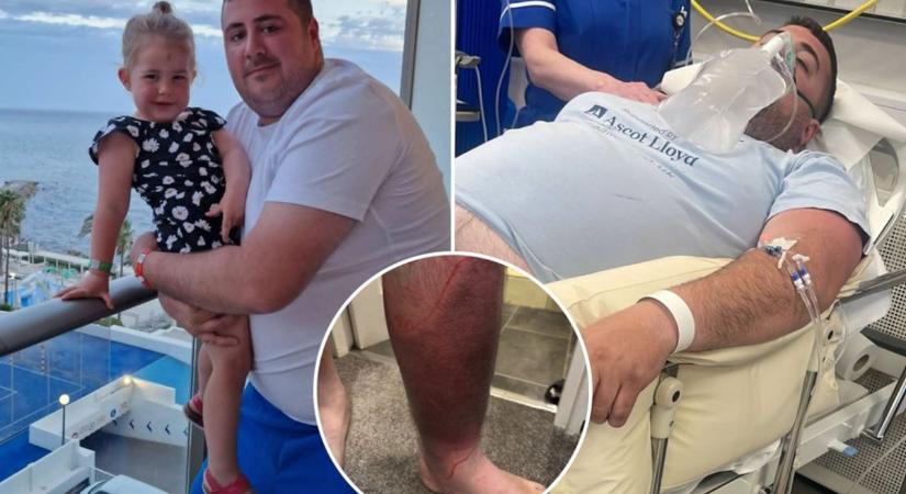 Egyetlen karcolás miatt, majdnem elvesztette a lábát egy édesapa: „Nem tudtam járni”