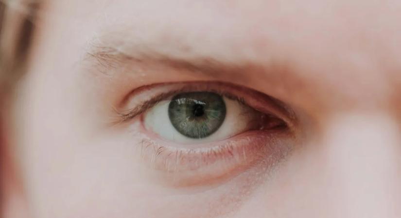 Rángatózik a szemhéjad? Komoly betegségekre is utalhat