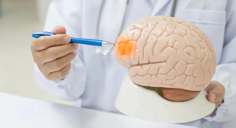 Ezzel az egyszerű lépéssel csökkentheti a stroke esélyét