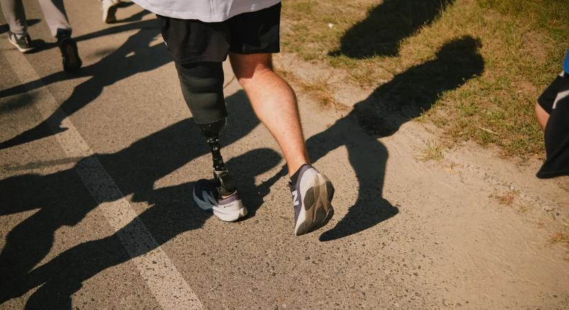 Egy férfi megépítette a saját lábprotézisét az amputációja után