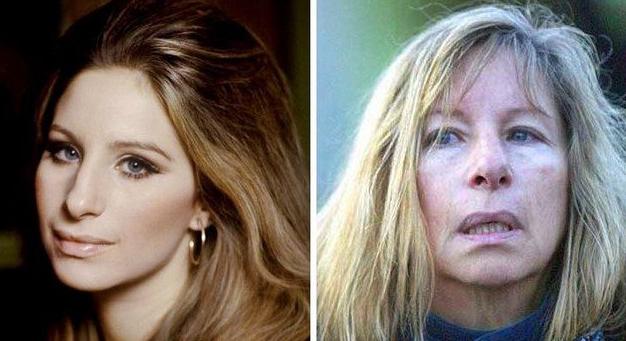 15 híresség, akik hatalmasat változtak néhány évtized leforgás alatt