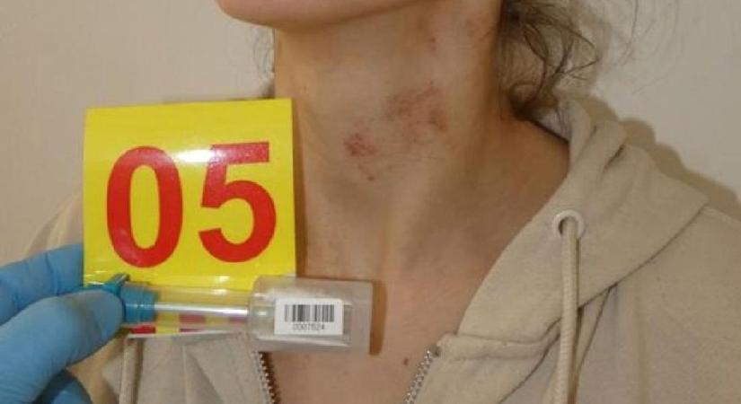 Felakasztotta magát a férfi, miután késsel fenyegette, megerőszakolta válófélben lévő feleségét