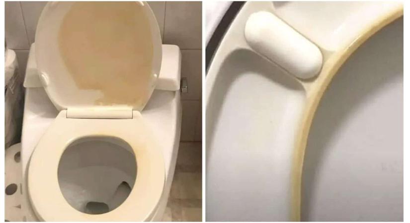 Majdnem kidobtam a WC-ülőkét, aztán kipróbáltam ezt az olcsó trükköt, és eltűnt a sárgaság