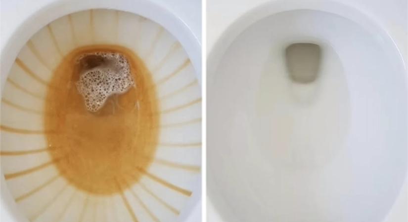 Így tűnik el a makacs barna folt a WC-ből – vegyszer nélkül, percek alatt