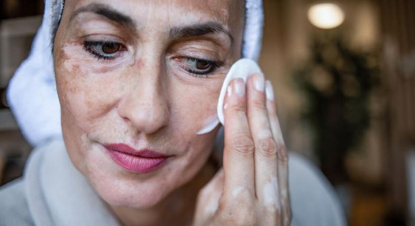 Autoimmun betegség: nehezen diagnosztizálható és gyógyítható