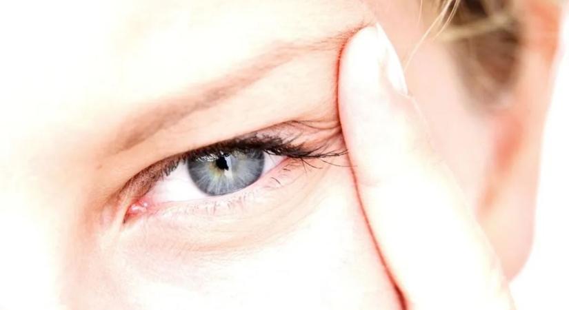 Rángatózó szemhéj: ártalmatlan jel vagy fontos figyelmeztetés?
