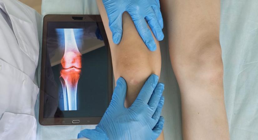 Először végeztek lábhosszabbító műtétet gyermeken Angliában