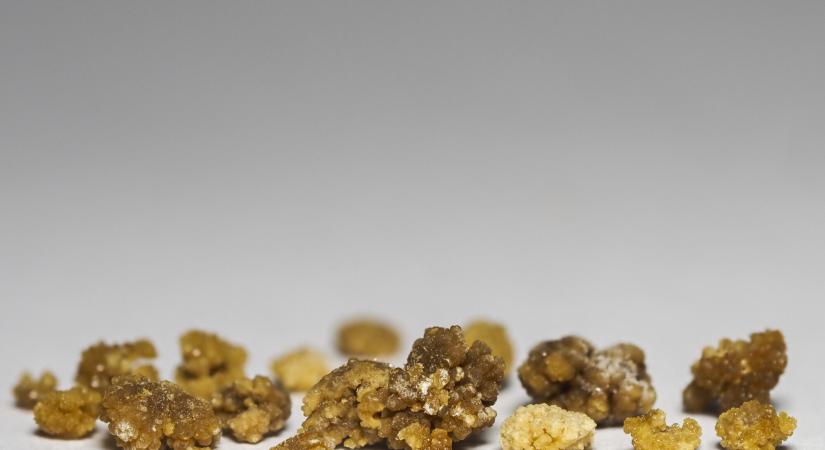 Aranyrögnek hitték, de csak a tulaj veseköveit lopták el a tolvajok