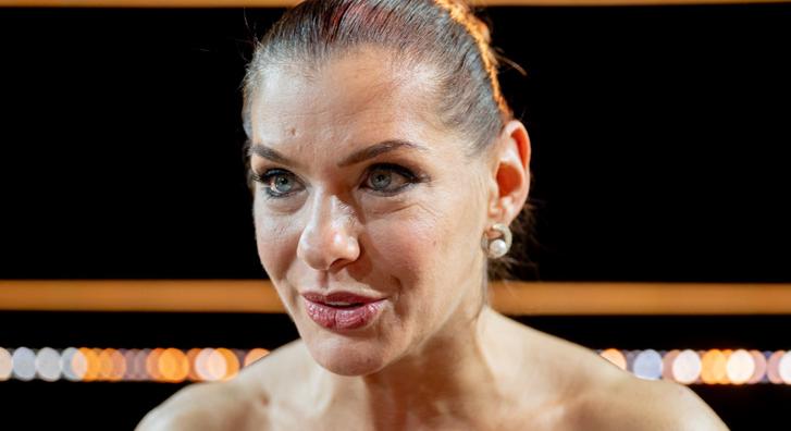 Dér Heni plasztikáztatta az arcát: „Minden nap lefotózom magam, hogy látszódjon a különbség”