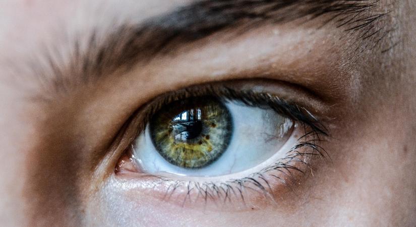 A magas koleszterinszint jele, ami a szemnél bukkanhat fel