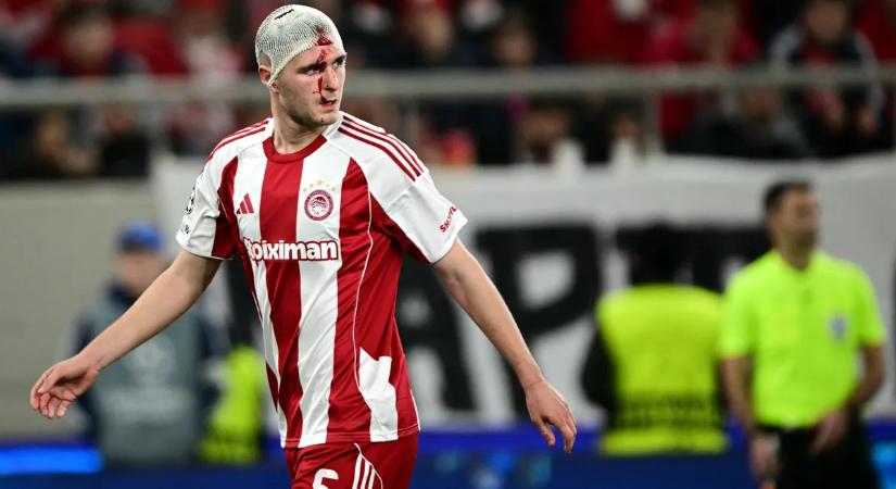 Hátborzongató ütközés: ömlött a vér a sztárfocisták fejéből a BL-meccsen – képek, videó