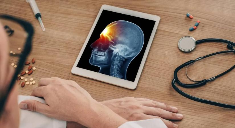 Ennél a vércsoportnál magas az agyvérzés kockázata