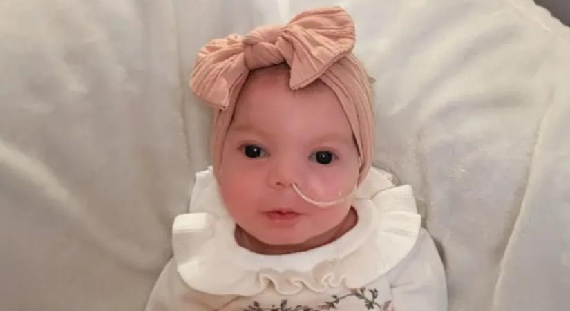 "El kell búcsúznunk gyönyörű kislányunktól" - Ritka betegség miatt rövid ideig maradhat életben az újszülött kislány