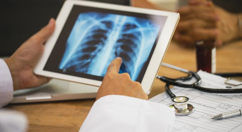 Kevesebb a légúti fertőzés, de megugrott az intenzíven kezeltek száma