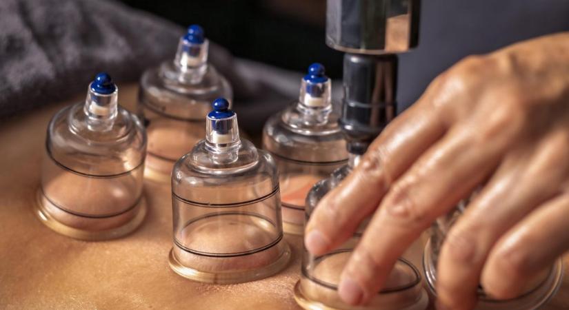 Szakértő válaszol: ezért NE használd a köpölyözést lipödémára