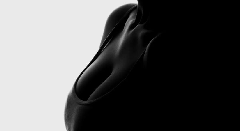 "Mellkisebbítő műtéten estem át, mert a férfiak állandóan bámultak"