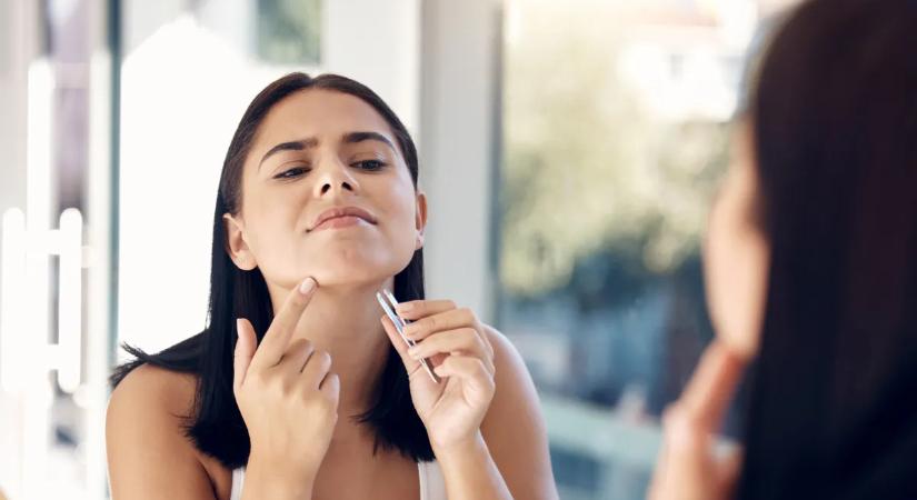 Sok nő küzd ezzel a problémával – A kozmetikus szerint így szabadulhatsz meg az erős arcszőrzettől
