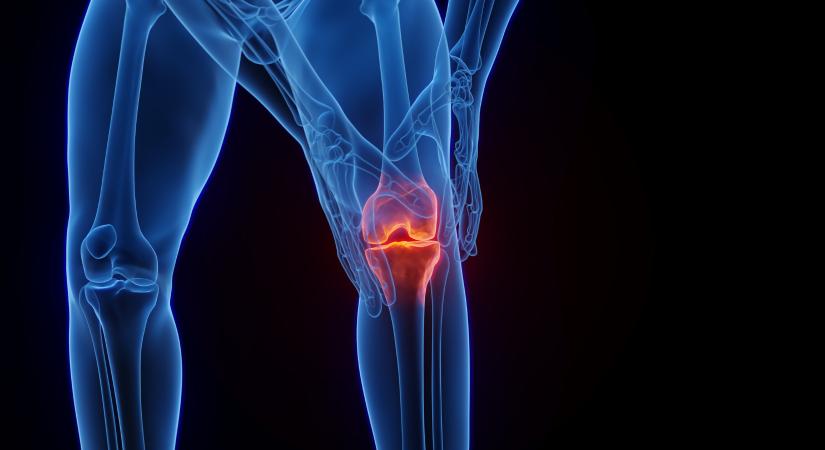 23 beteg halt meg a szegedi térdprotézis-várólistáról, mielőtt még sorra kerültek volna