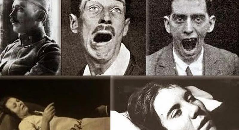 A járvány, amely élő testbe zárta az embereket  Videó!