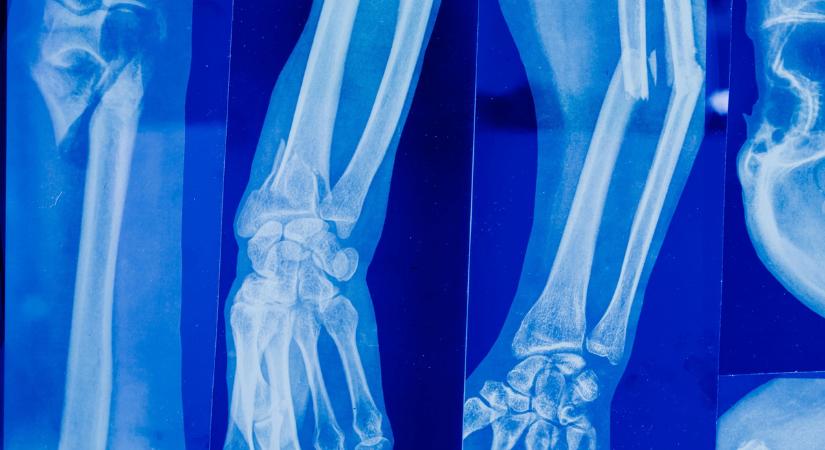 „27 évesen időskori betegséget diagnosztizáltak nálam"