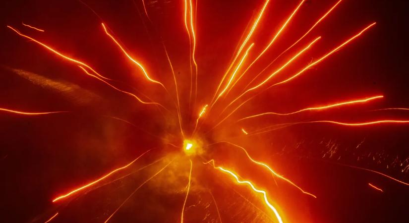 Az arcába robbant a kandalló: azóta is a régi életéért küzd