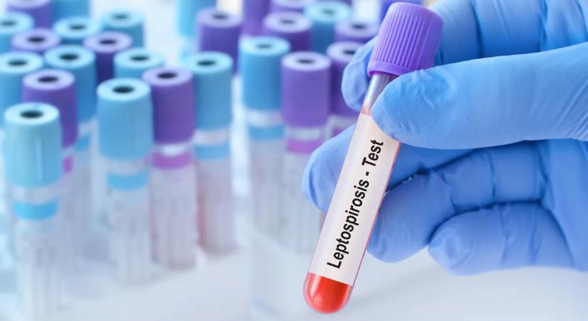 Nem a lepra fáj a legjobban, hanem a megbélyegzés – Így él ma velünk a milliókat érintő kór