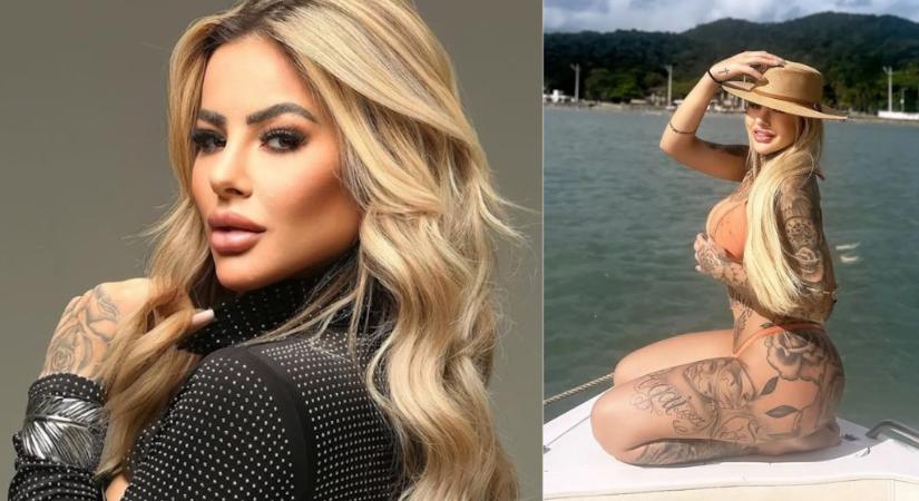 27 évesen meghalt egy plasztikai műtét után lábadozó influenszer