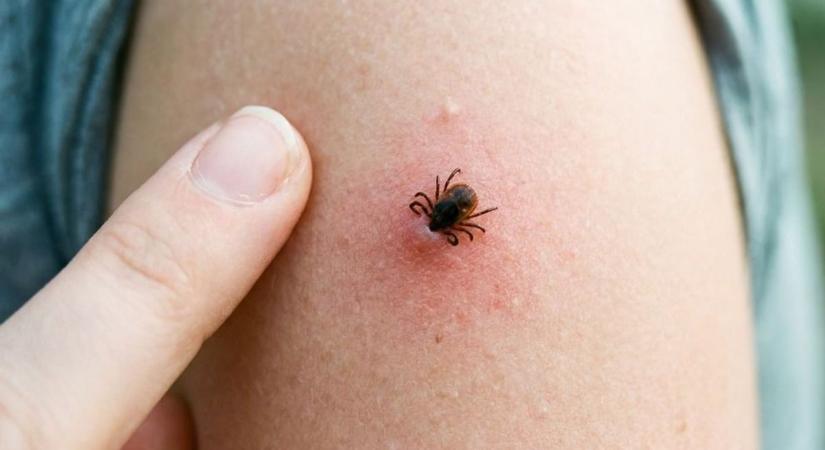 Mit tesz a fagy a kullancsokkal valójában? (videó)