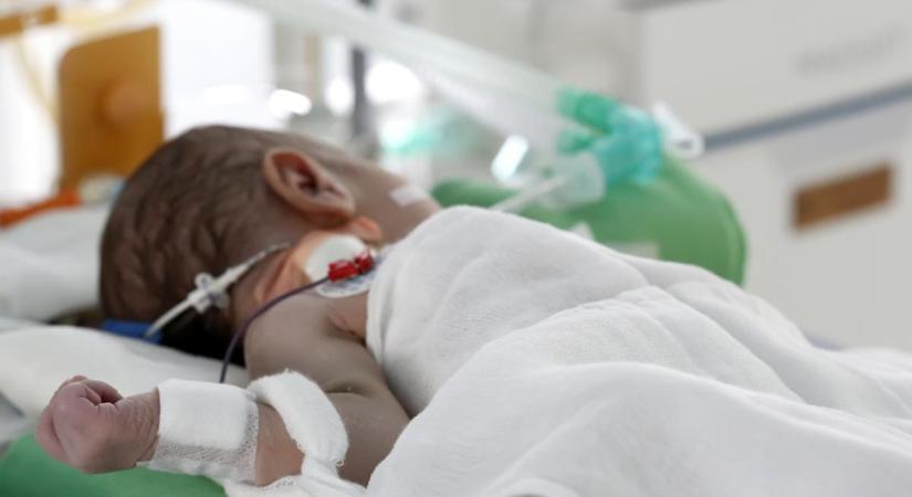 Meghalt egy kétéves kisfiú Olaszországban rosszul sikerült szívtranszplantáció következtében