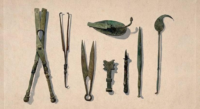 Így operáltak az ókori Rómában – hátborzongató eszközöket használtak