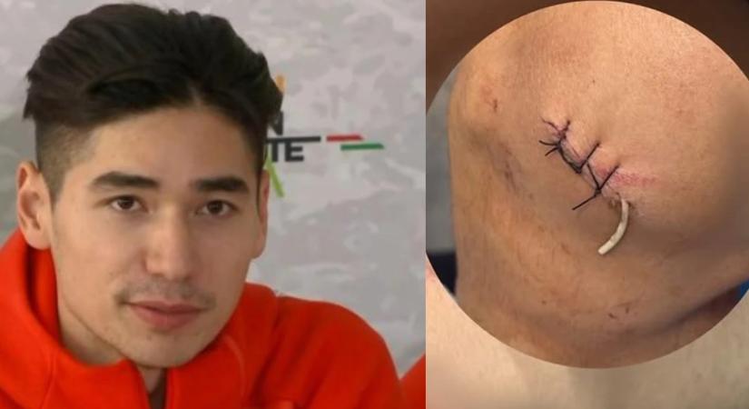 Csúnya sérülés árnyékolhatta be Liu Shaoang teljesítményét a téli olimpián