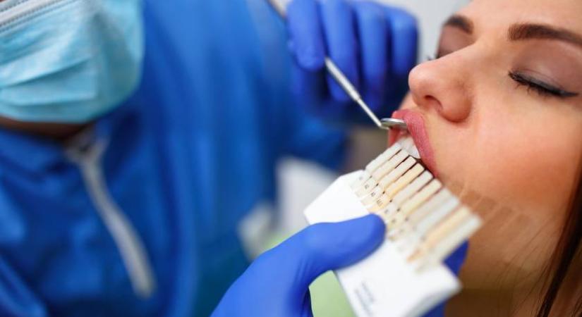 Barnás elszíneződések a fogakon: nem biztos, hogy szuvasodás áll a háttérben