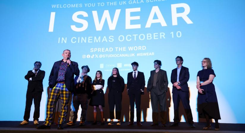 Kínos és zavarba ejtő esemény szakította félbe a BAFTA-gálát