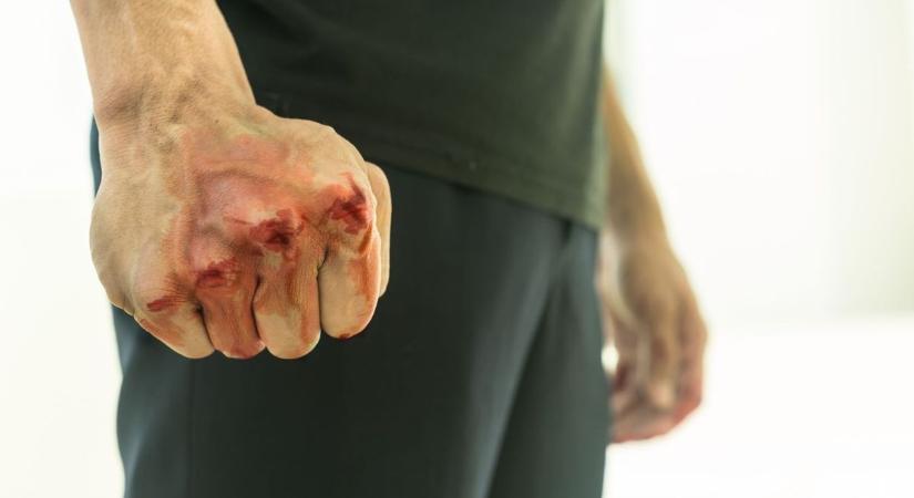 Agyba-főbe verte haragosát egy férfi az egyik körmendi benzinkúton - maradandó fogyatékosság lett a vége