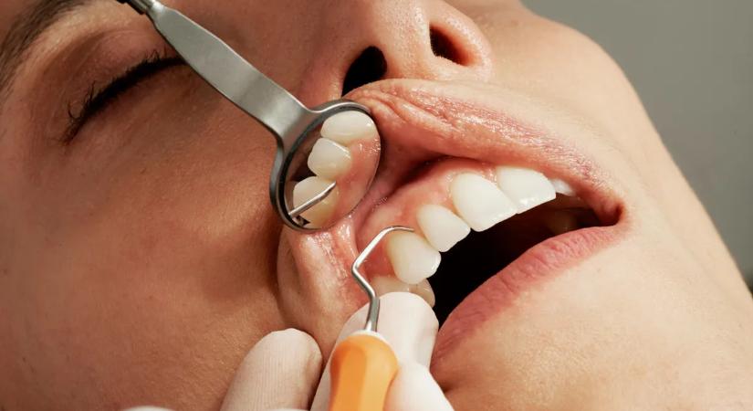 A nő azt hitte, csak fáj a szája – rémes diagnózis okozott döbbenetet